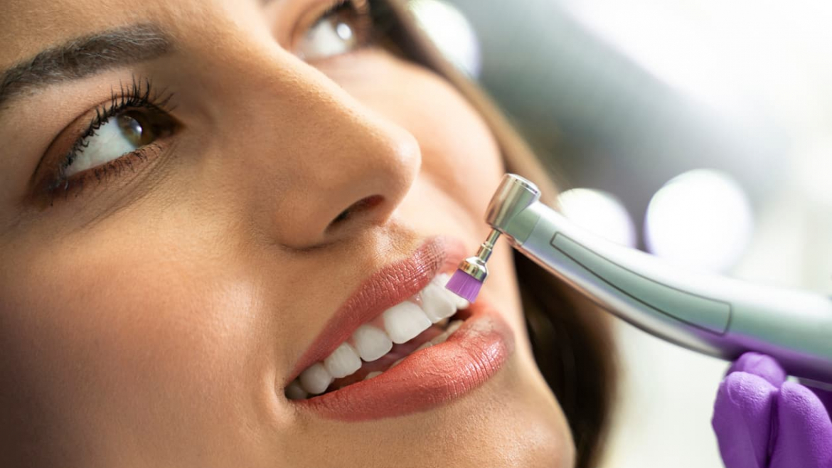 Why You Should Get Your Teeth Professionally Cleaned
