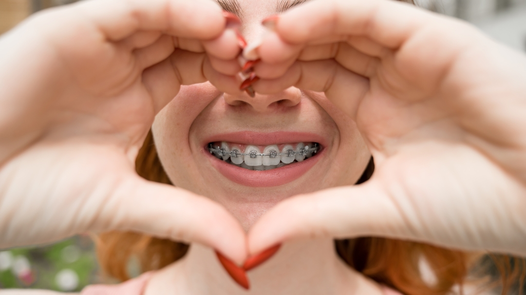 Close-up portrait of a young red-haired woman with braces on her teeth holding her hands in the shape of a heart. Orthodontic appliances for a perfect smile