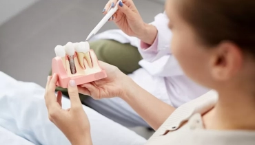 What are Dental Implants (and How Can You Benefit from Them)?