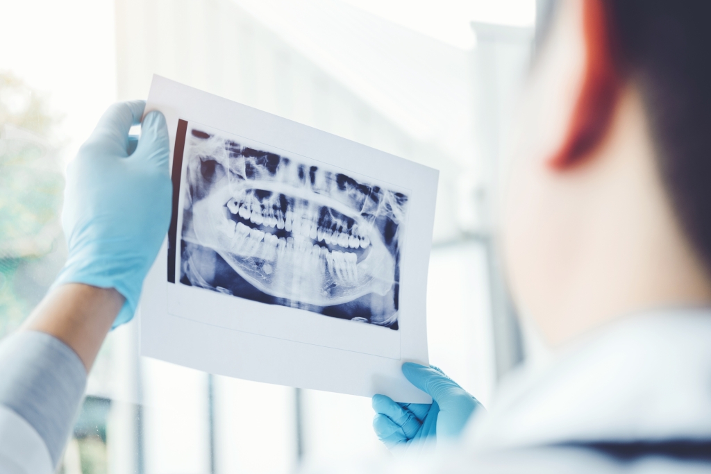 Dentist consulting with patient presenting results on Dental x-ray film 